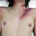 Daisy Ridley Frontal Nude Scenes From Silent Witness